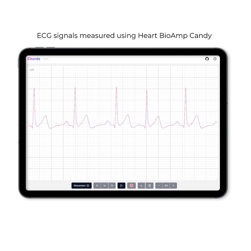 Upside Down Labs Heart BioAmp Candy ECG Sensor - 3.5V-5V ADC, 3-Electrode, Kit w/ Cable & Electrodes - Image 3